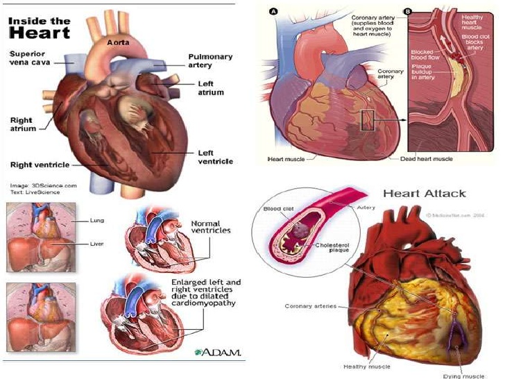 Cardiac Diseases, Symptoms, Causes & Treatment
